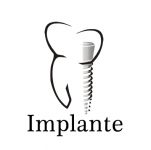 implante-dentario-inga%CC%81