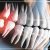 cirurgia-oral-menor-pedro-keopoldo