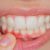 dente-canal-pedro-leopoldo