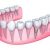 protese=dentaria=em-sao-goncalo