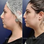 dentista-em-sao-caetano-do-sul-
