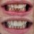 dentista-em-sao-caetano-do-sul-10