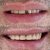 dentista-em-sao-caetano-do-sul-11