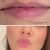 dentista-em-sao-caetano-do-sul-8