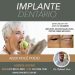 implante-dentario-em-copacabana
